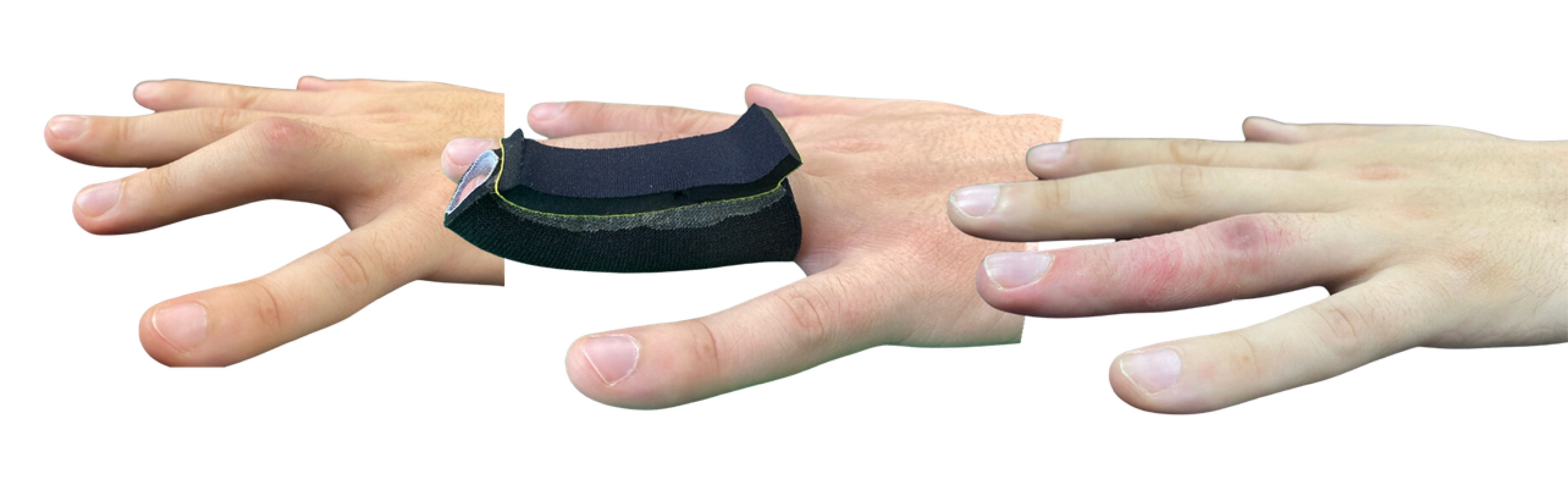 Fisioterapia para  rigidez de la mano en Hermosillo